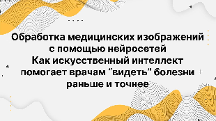 Обработка медицинских изображений с помощью нейросетей. Как искусственный интеллект помогает врачам “видеть” болезни раньше и точнее