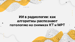 ИИ в радиологии: как алгоритмы распознают патологию на снимках КТ и МРТ